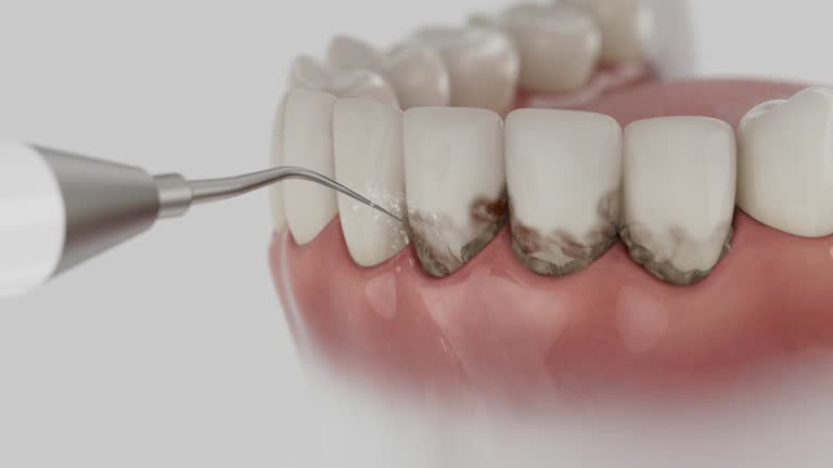 Trusted Root Canal Treatment service in Chester, MD - Dentist Open Now